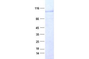 Validation with Western Blot