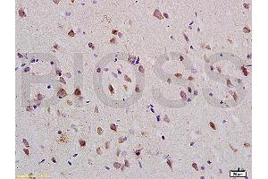 Formalin-fixed and paraffin embedded: rat brain tissue labeled with Anti-Nogo-R Polyclonal Antibody (ABIN725420), Unconjugated at 1:200 followed by conjugation to the secondary antibody and DAB staining (RTN4R anticorps  (AA 151-350))