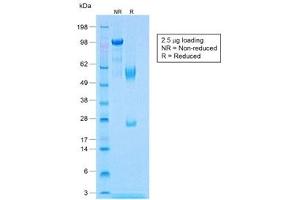 SDS-PAGE analysis of purified, BSA-free recombinant Calponin antibody (clone CNN1/1408R) as confirmation of integrity and purity. (Recombinant Calponin anticorps)