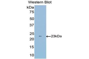 Western Blotting (WB) image for anti-Fibulin 1 (FBLN1) (AA 399-578) antibody (ABIN1175705) (Fibulin 1 anticorps  (AA 399-578))