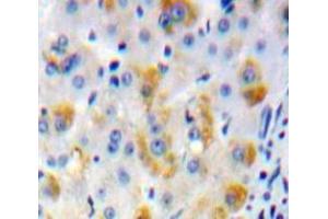 IHC-P analysis of Liver tissue, with DAB staining. (ADCY2 anticorps  (AA 294-525))