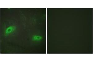 Immunofluorescence analysis of HeLa cells, using TNFSF9 Antibody. (TNFSF9 anticorps  (AA 31-80))