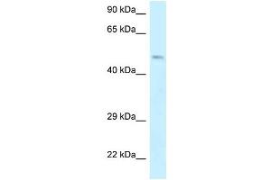 Western Blot showing EPB49 antibody used at a concentration of 1 ug/ml against Jurkat Cell Lysate (Dematin anticorps  (Middle Region))