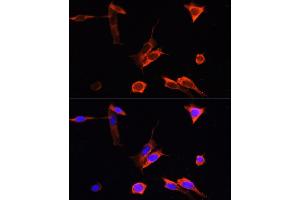 Immunofluorescence analysis of NIH-3T3 cells using PINK1 Rabbit pAb (ABIN6128458, ABIN6145666, ABIN6145668 and ABIN6222945) at dilution of 100 (40x lens).