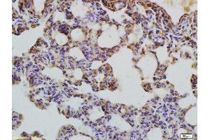 Formalin-fixed and paraffin embedded rat brain labeled with Rabbit Anti-LC3 Polyclonal Antibody, Unconjugated  and DAB staining.