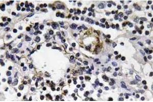 Immunohistochemistry (IHC) analyzes of IFN-gamma antibody in paraffin-embedded human lymph node tissue. (Interferon gamma anticorps)