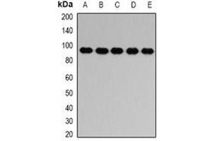 Western blot analysis of PTP epsilon expression in HL60 (A), SW620 (B), mouse brain (C), mouse spleen (D), rat lung (E) whole cell lysates. (PTPRE anticorps)