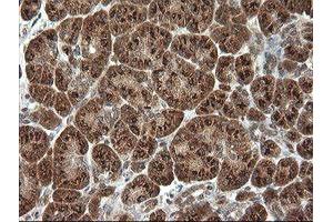 Image no. 9 for anti-Phosphoinositide-3-Kinase, Catalytic, gamma Polypeptide (PIK3CG) antibody (ABIN1500207)