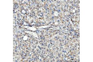 IHC analysis of HLA-DPB1 using anti-HLA-DPB1 antibody (ABIN4886618).