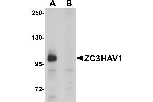 Western Blotting (WB) image for anti-Zinc Finger CCCH-Type, Antiviral 1 (ZC3HAV1) (C-Term) antibody (ABIN1030817) (ZC3HAV1 anticorps  (C-Term))
