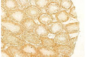 ABIN6263424 and ABIN6269252 at 1/100 staining Rat testis tissue by IHC-P.