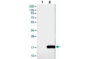 Western blot analysis of Lane 1: Negative control (vector only transfected HEK293T lysate), Lane 2: Over-expression Lysate (Co-expressed with a C-terminal myc-DDK tag (~3. (INIP anticorps)