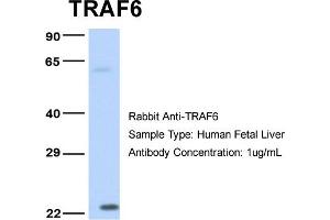 Host: Rabbit Target Name: TRAF6 Sample Type: Human Fetal Liver Antibody Dilution: 1. (TRAF6 anticorps  (Middle Region))