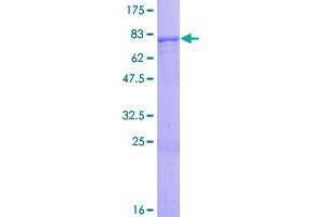 Image no. 1 for Zinc Finger Protein 554 (ZNF554) (AA 1-538) protein (GST tag) (ABIN1326281)
