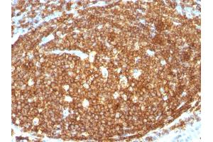 Formalin-fixed, paraffin-embedded human Tonsil stained with CD45RB Rabbit Polyclonal Antibody.