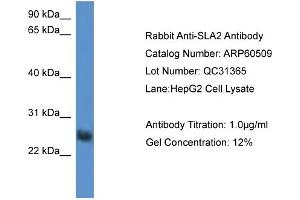 WB Suggested Anti-SLA2  Antibody Titration: 0.