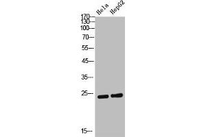 Western Blot analysis of Hela HepG2 cells using AID Polyclonal Antibody (AICDA anticorps  (Internal Region))