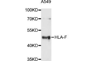 Western blot analysis of extracts of A-549 cells, using HLA-F antibody (ABIN5997910) at 1/1000 dilution. (HLA-F anticorps)