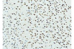 IHC analysis of RPL23 using anti-RPL23 antibody (ABIN7599808).