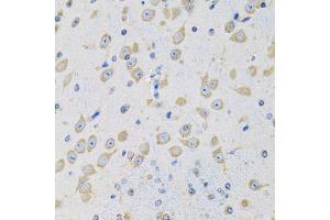 Immunohistochemistry of paraffin-embedded mouse brain using MSRA antibody (ABIN5973791) at dilution of 1/100 (40x lens). (MSRA anticorps)