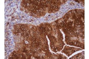 Image no. 3 for anti-Isocitrate Dehydrogenase 1 (NADP+), Soluble (IDH1) antibody (ABIN1502107)