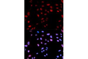 Immunofluorescence (IF) image for anti-Histone Cluster 1, H3b (HIST1H3B) (pThr12) antibody (ABIN1870229) (Histone H3.1 anticorps  (pThr12))