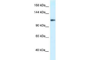 WB Suggested Anti-KCNH3 Antibody Titration: 1. (KCNH3 anticorps  (N-Term))