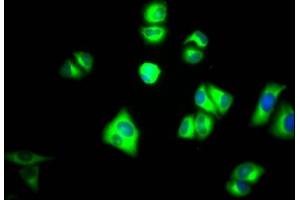 Immunofluorescence staining of Hela Cells with ABIN7127769 at 1:50, counter-stained with DAPI. (Recombinant PKM anticorps)