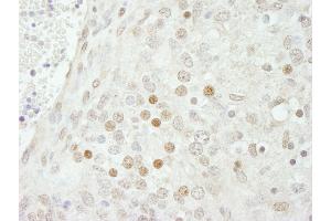 Immunohistochemistry (IHC) image for anti-SWI/SNF Related, Matrix Associated, Actin Dependent Regulator of Chromatin, Subfamily B, Member 1 (SMARCB1) (AA 75-125) antibody (ABIN7448800)