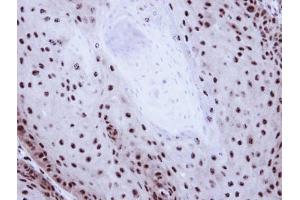 IHC-P Image Immunohistochemical analysis of paraffin-embedded Cal27 Xenograft, using GABP-beta1, antibody at 1:100 dilution.