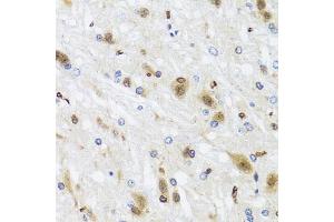 Immunohistochemistry of paraffin-embedded rat brain using HDAC4 antibody (ABIN4903045) at dilution of 1:100 (40x lens).
