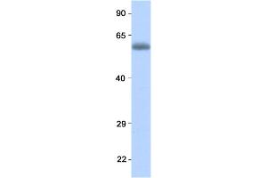 Host:  Rabbit  Target Name:  RELA  Sample Type:  Human Fetal Lung  Antibody Dilution:  1.