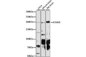 Western blot analysis of extracts of various cell lines, using KDM5B antibody  at 1:1000 dilution. (KDM5B anticorps  (AA 784-883))