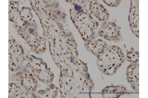 Image no. 1 for anti-SMC6 Structural Maintenance of Chromosomes 6-Like 1 (SMC6) (AA 1-110) antibody (ABIN599304) (SMC6 anticorps  (AA 1-110))
