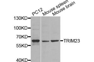 Western blot analysis of extracts of various cell lines, using TRIM23 antibody (ABIN5974665) at 1/1000 dilution. (TRIM23 anticorps)