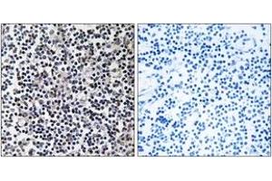 Immunohistochemistry (IHC) image for anti-Transforming, Acidic Coiled-Coil Containing Protein 3 (TACC3) (AA 789-838) antibody (ABIN2890716) (TACC3 anticorps  (AA 789-838))