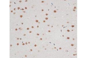 Immunohistochemistry of paraffin-embedded Rat brain using ZNF148 Polyclonal Antibody at dilution of 1:100 (40x lens).