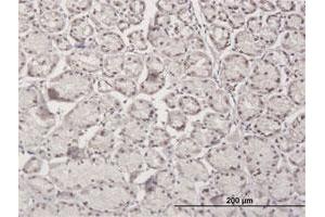 Immunoperoxidase of purified MaxPab antibody to RBM5 on formalin-fixed paraffin-embedded human stomach.