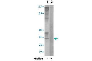 Western blot analysis of extracts from K-562 cells, using CIB3 polyclonal antibody . (CIB3 anticorps  (C-Term))