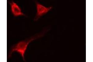 ABIN6277345 staining  MCF7 cells by IF/ICC. (USO1 anticorps  (C-Term))