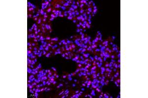 Immunofluorescence of paraffin embedded rat lung using SUV39H1 (ABIN7075770) at dilution of 1:1000 (400x lens) (SUV39H1 anticorps)