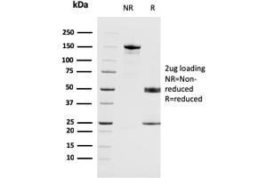SDS-PAGE Analysis Purified MAGEA4 Mouse Monoclonal Antibody (CPTC-MAGEA4-1).