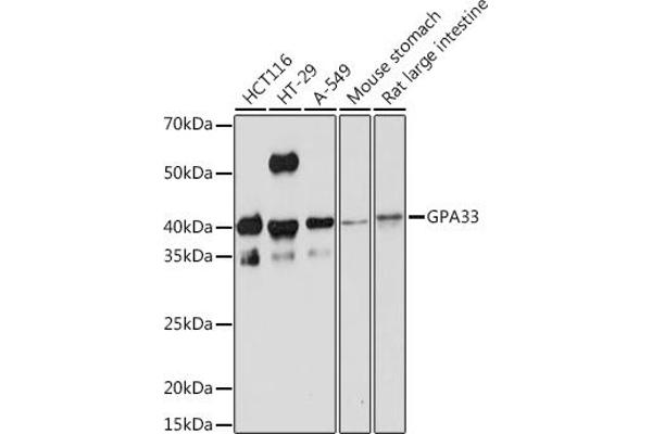 GPA33 anticorps
