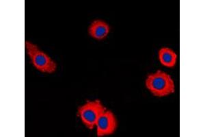 Immunofluorescent analysis of MUC16 staining in HuvEc cells. (MUC16 anticorps  (Center))