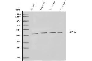 Western blot analysis of KCNJ1 using anti-KCNJ1 antibody (ABIN7603179).