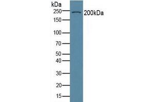 Detection of COL6a3 in Human Serum using Polyclonal Antibody to Collagen Type VI Alpha 3 (COL6a3)