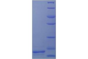 Transforming Growth Factor, beta 1 (TGFB1) (AA 30-278) protein (His tag) expressed in E.
