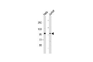 All lanes : Anti-NSUN2 Antibody (Center) at 1:1000 dilution Lane 1: Hela whole cell lysate Lane 2: Jurkat whole cell lysate Lysates/proteins at 20 μg per lane.