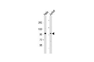 All lanes : Anti-NSUN2 Antibody (Center) at 1:1000 dilution Lane 1: Hela whole cell lysate Lane 2: Jurkat whole cell lysate Lysates/proteins at 20 μg per lane. (NSUN2 anticorps  (AA 423-451))
