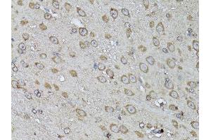 Immunohistochemistry of paraffin-embedded mouse brain using SNAI1 antibody.